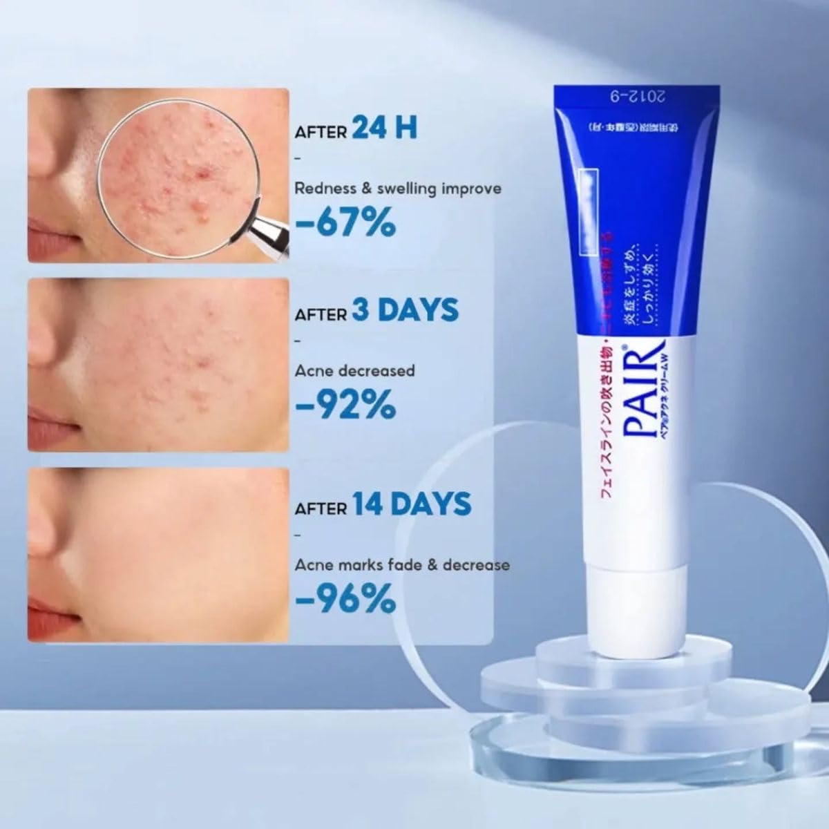 Pair Lion Acne Cream