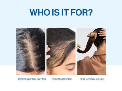 Advanced Hair Growth Roll‑On Serum