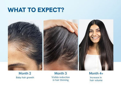 Advanced Hair Growth Roll‑On Serum